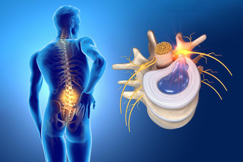 #1 Nerve Pain Treatment in : Symptoms, Causes, Diagnosis