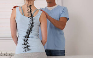 Scoliosis Spine Curve Anatomy,
